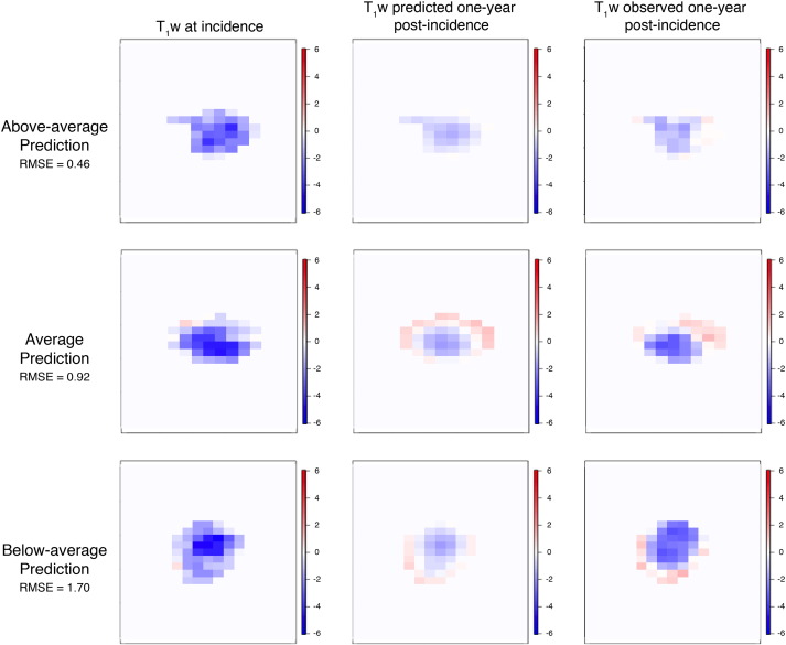 Predicting Degree and Spatial Pattern of MS Lesion Tissue Recovery Image