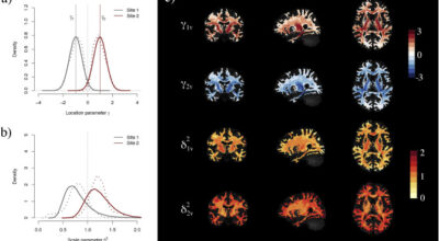 Harmonization of multi-site diffusion tensor imaging data Image