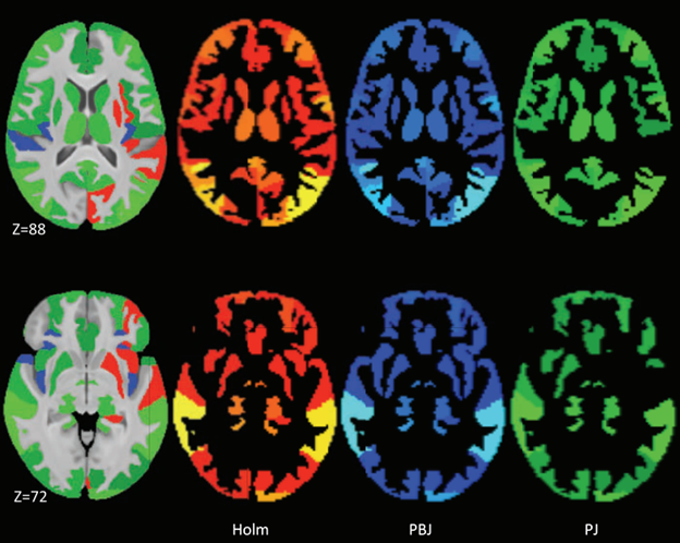 Faster family-wise error control for neuroimaging with a parametric bootstrap Image