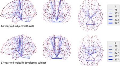 Distance-Based Analysis of Variance for Brain Connectivity Image