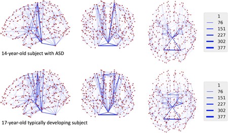 Distance-Based Analysis of Variance for Brain Connectivity Image