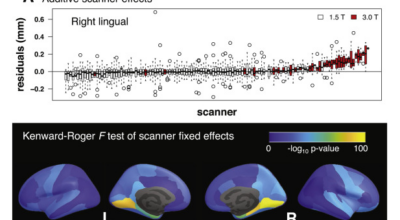 Longitudinal ComBat: A method for harmonizing longitudinal multi-scanner imaging data Image