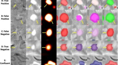 Fully Automated Detection of Paramagnetic Rims in Multiple Sclerosis Lesions on 3T Susceptibility-Based MR Imaging Image