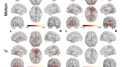 Robust Spatial Extent Inference with a Semiparametric Bootstrap Joint Inference Procedure Image