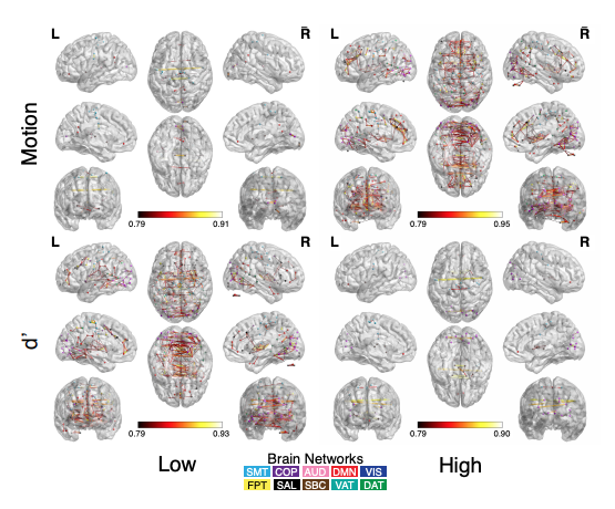 Robust Spatial Extent Inference with a Semiparametric Bootstrap Joint Inference Procedure Image