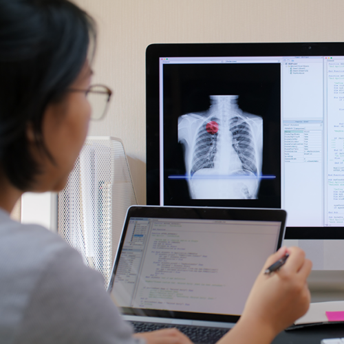 Close-up of a person reviewing a medical image and laptop with programmatic language.