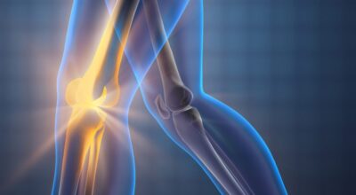 Dr. Joshua Baker’s Review, “Metabolic Consequences of Rheumatoid Arthritis” Image