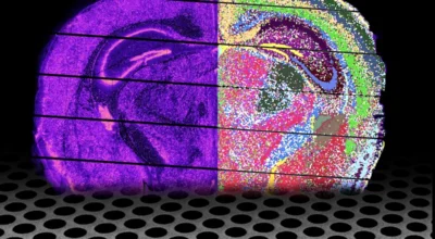 iSCALE Unlocks Molecular Maps of Large Human Tissues Image