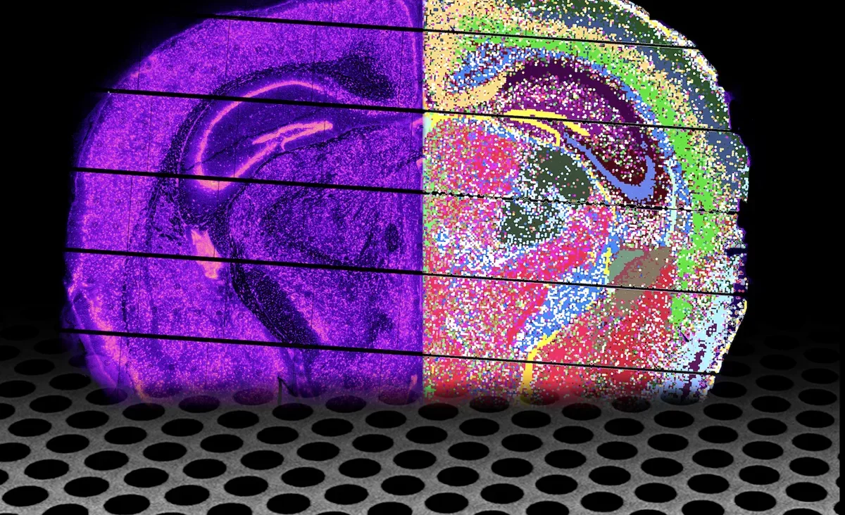 iSCALE Unlocks Molecular Maps of Large Human Tissues Image